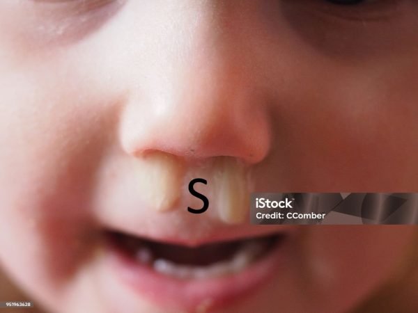 2-3 Years Old Child with a booger snotty nose
